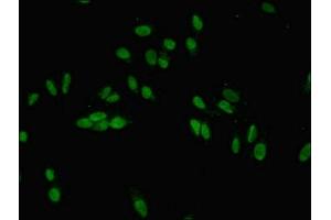 Immunofluorescent analysis of Hela cells using ABIN7165672 at dilution of 1:100 and Alexa Fluor 488-congugated AffiniPure Goat Anti-Rabbit IgG(H+L) (JARID2 抗体  (AA 1-159))