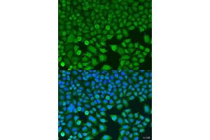 Immunofluorescence analysis of U2OS cells using BCKDK antibody (ABIN6127484, ABIN6137492, ABIN6137493 and ABIN6224210) at dilution of 1:100. (BCKDK 抗体  (AA 153-412))