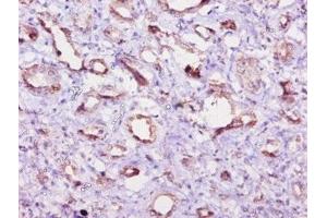 Immunohistochemistry of paraffin-embedded human kidney tissue using ABIN7152198 at dilution of 1:10 (eIF4EBP2 抗体  (AA 1-120))