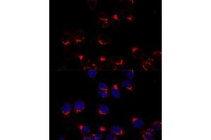 Confocal immunofluorescence analysis of Hela cells using USO1 antibody (ABIN7271235) at dilution of 1:200. (USO1 抗体  (AA 663-962))