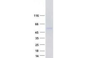 Western Blotting (WB) image for phosphodiesterase 9A (PDE9A) (Transcript Variant 13) protein (Myc-DYKDDDDK Tag) (ABIN2728528)
