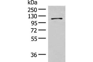 Western blot analysis of Hela cell lysate using FANCB Polyclonal Antibody at dilution of 1:550 (FANCB 抗体)