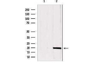 Western blot analysis of extracts from mouse brain, using CPLX1 antibody. (Complexin 1 抗体  (N-Term))