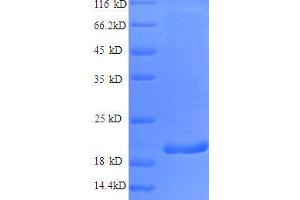 SDS-PAGE (SDS) image for Interferon gamma (IFNG) (AA 24-161), (partial) protein (His tag) (ABIN1047217)