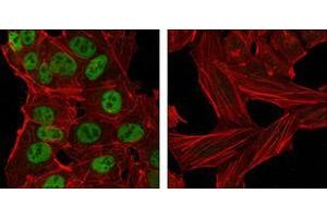 Confocal immunofluorescence analysis of NTERA-2 cells (left) and HeLa cells (right) using Nanog mouse mAb (green). (Nanog 抗体  (AA 20-166))