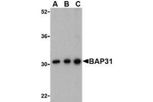Western blot analysis of BAP31 in Ramos cell lysate with AP30123PU-N BAP31 antibody at (A) 0. (BCAP31 抗体  (C-Term))