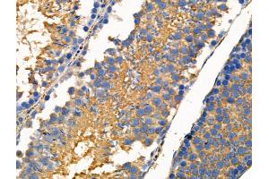Phospho-FGF23 (Ser212) Antibody at 1/100 staining Mouse testis tissue by IHC-P. (FGF23 抗体  (pSer212))