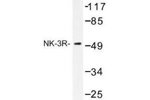 Image no. 1 for anti-Tachykinin Receptor 3 (TACR3) antibody (ABIN317708) (TACR3 抗体)