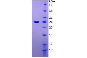 SDS-PAGE of Protein Standard from the Kit  (Highly purified E. (TIE1 ELISA 试剂盒)