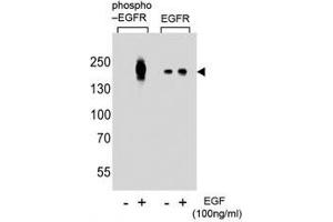 Western blot analysis of lysate from A431 cells (left to right), untreated or treated with EGF at 100ng/ml, using phospho-EGFR antibody (pY1016) or nonphos Ab at 1:8000 dilution.