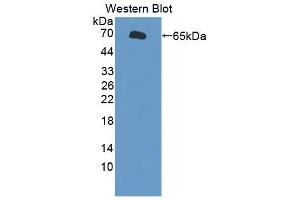 Detection of Recombinant TAT1, Human using Polyclonal Antibody to Testis Anion Transporter 1 (TAT1) (SLC26A8 抗体  (AA 664-970))