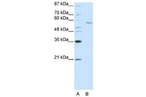WB Suggested Anti-RCOR1  Antibody Titration: 0. (CoREST 抗体  (C-Term))