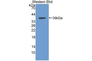 Western blot analysis of the recombinant protein. (NCOA3 抗体  (AA 1-269))