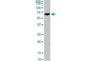 Western Blotting (WB) image for anti-Cytochrome P450, Family 4, Subfamily V, Polypeptide 2 (CYP4V2) (AA 1-525) antibody (ABIN949935)