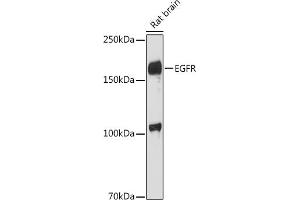 Western blot analysis of extracts of Rat brain, using EGFR antibody (ABIN6133681, ABIN6139977, ABIN6139982 and ABIN6219256) at 1:1000 dilution. (EGFR 抗体  (AA 1100-1200))