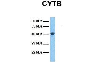 Host:  Rabbit  Target Name:  CYTB  Sample Tissue:  Human Fetal Liver  Antibody Dilution:  1. (Cytochrome b 抗体  (N-Term))