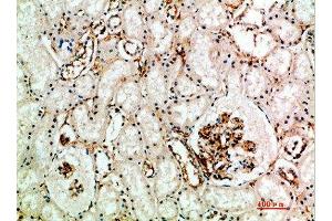 Immunohistochemical analysis of paraffin-embedded human-kidney, antibody was diluted at 1:200 (Endoglin 抗体  (AA 370-430))