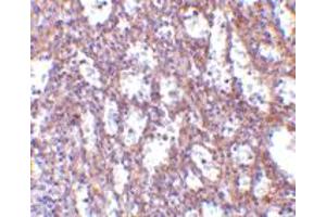 Immunohistochemistry of IL32 in human spleen tissue with IL32 polyclonal antibody  at 10 ug/mL . (IL32 抗体  (C-Term))