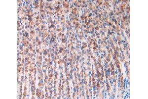 IHC-P analysis of stomach tissue, with DAB staining. (IL1R1 抗体  (AA 119-217))