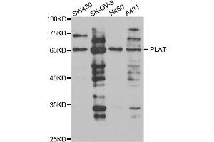Western blot analysis of extracts of various cell lines, using PLAT antibody (ABIN5973300) at 1/1000 dilution. (PLAT 抗体)