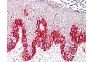 Anti-SIRT1 antibody IHC of human skin. (SIRT1 抗体  (AA 577-590))