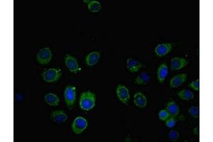 Immunofluorescent analysis of A549 cells using ABIN7171008 at dilution of 1:100 and Alexa Fluor 488-congugated AffiniPure Goat Anti-Rabbit IgG(H+L) (SOCS6 抗体  (AA 1-210))