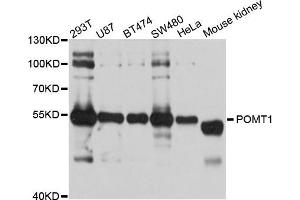 Western blot analysis of extracts of various cell lines, using POMT1 antibody (ABIN5998570) at 1/1000 dilution. (POMT1 抗体)