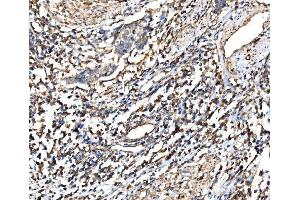 IHC analysis of RPL32 using anti-RPL32 antibody (ABIN7601826). (RPL32 抗体  (AA 48-129))