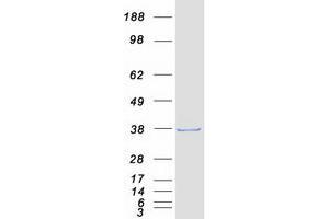 Western Blotting (WB) image for MAD2L1 Binding Protein (MAD2L1BP) (Transcript Variant 2) protein (Myc-DYKDDDDK Tag) (ABIN2725125)