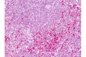 Anti-PTPRE antibody IHC of human spleen. (PTPRE 抗体  (Cytoplasmic Domain))
