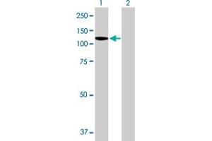 Western Blot analysis of DDX11 expression in transfected 293T cell line by DDX11 MaxPab polyclonal antibody. (DDX11 抗体  (AA 1-970))