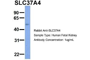 Host:  Rabbit  Target Name:  SLC37A4  Sample Type:  Human Fetal Kidney  Antibody Dilution:  1. (SLC37A4 抗体  (Middle Region))