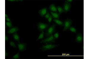 Immunofluorescence of monoclonal antibody to OXSR1 on HeLa cell. (OXSR1 抗体  (AA 1-527))