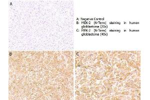 Immunohistochemistry (IHC) image for anti-Mitogen-Activated Protein Kinase Kinase 2 (MAP2K2) (C-Term) antibody (ABIN5706745)