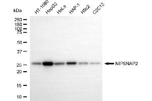 Western blotting analysis using NIPSNAP2 antibody (ABIN7798724). (GBAS 抗体)