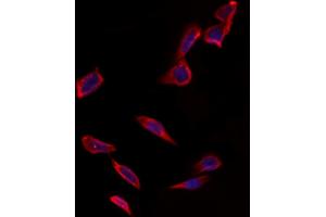 ABIN6265960 and ABIN6273343 staining Hela by IF/ICC.