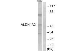 Western blot analysis of extracts from K562 cells, using ALDH1A2 antibody. (ALDH1A2 抗体  (C-Term))
