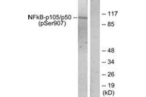 Western blot analysis of extracts from HeLa cells treated with TNF-alpha, using NF-kappaB p105/p50 (Phospho-Ser907) Antibody. (NFKB1 抗体  (pSer907))