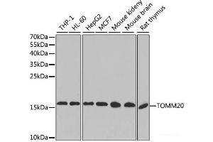 Western blot analysis of extracts of various cell lines, using TOMM20 antibody. (TOMM20 抗体)