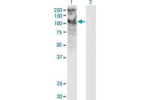Western Blotting (WB) image for anti-Transient Receptor Potential Cation Channel, Subfamily C, Member 5 (TRPC5) (AA 534-603) antibody (ABIN948593)