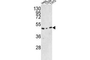 Western Blotting (WB) image for anti-Chromosome 9 Open Reading Frame 156 (C9orf156) antibody (ABIN3002894) (C9orf156 抗体)
