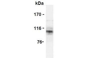 Western Blotting (WB) image for anti-Amyloid beta (A4) Precursor Protein (APP) (AA 18-38) antibody (ABIN1449275) (APP 抗体  (AA 18-38))