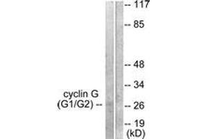 Western blot analysis of extracts from Jurkat cells, using Cyclin G Antibody. (Cyclin G1 抗体  (AA 161-210))