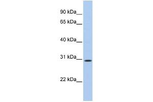 WB Suggested Anti-C20orf10 Antibody Titration: 0.