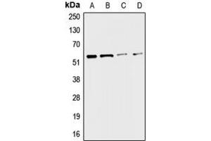 Western blot analysis of CHRNA3 expression in A549 (A), HepG2 (B), mouse liver (C), rat kidney (D) whole cell lysates. (CHRNA3 抗体  (Center))