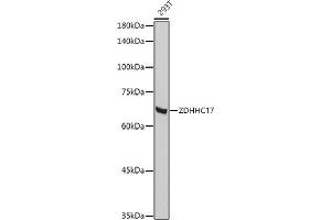 Western blot analysis of extracts of 293T cells, using ZDHHC17 antibody (ABIN6130455, ABIN6150416, ABIN6150417 and ABIN6222540) at 1:1000 dilution. (ZDHHC17 抗体  (AA 170-310))