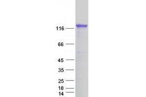 Validation with Western Blot