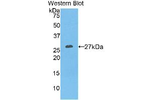 Western blot analysis of the recombinant protein. (Prostate Specific Antigen 抗体  (AA 39-261))