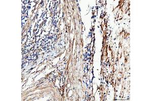 IHC analysis of Collagen III/COL3A1 using anti-Collagen III/COL3A1 antibody (ABIN6719295).