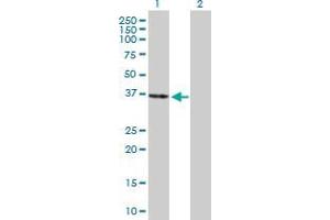 Lane 1: PEX26 transfected lysate ( 33. (PEX26 293T Cell Transient Overexpression Lysate(Denatured))